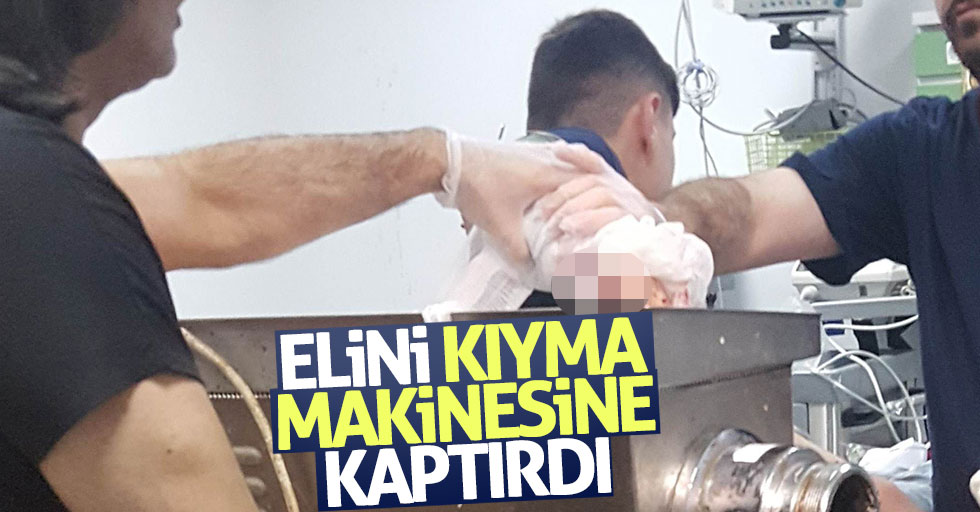 Samsun'da çocuk elini kıyma makinesine kaptırdı