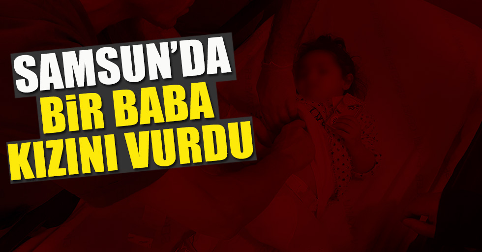 Samsun'da aile içi şiddet!