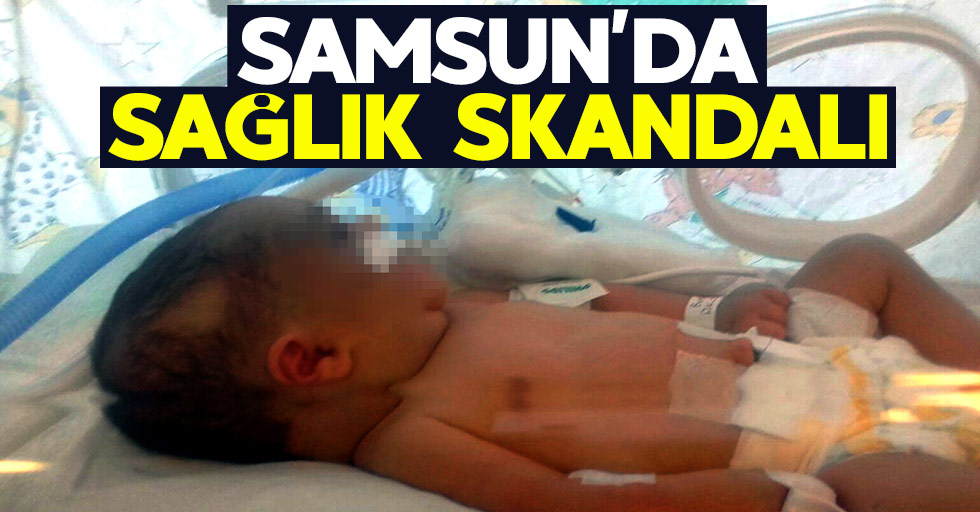 Samsun'da sağlık skandalı