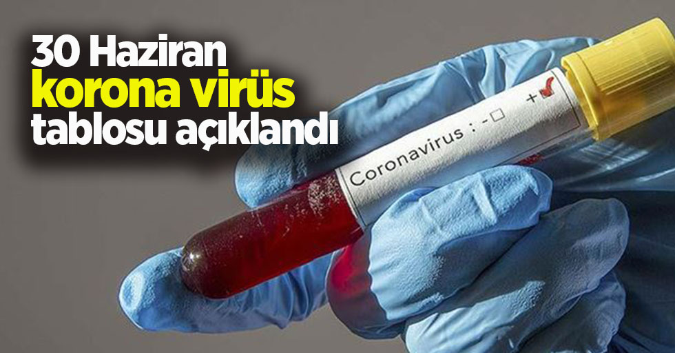 30 Haziran korona virüs tablosu açıklandı