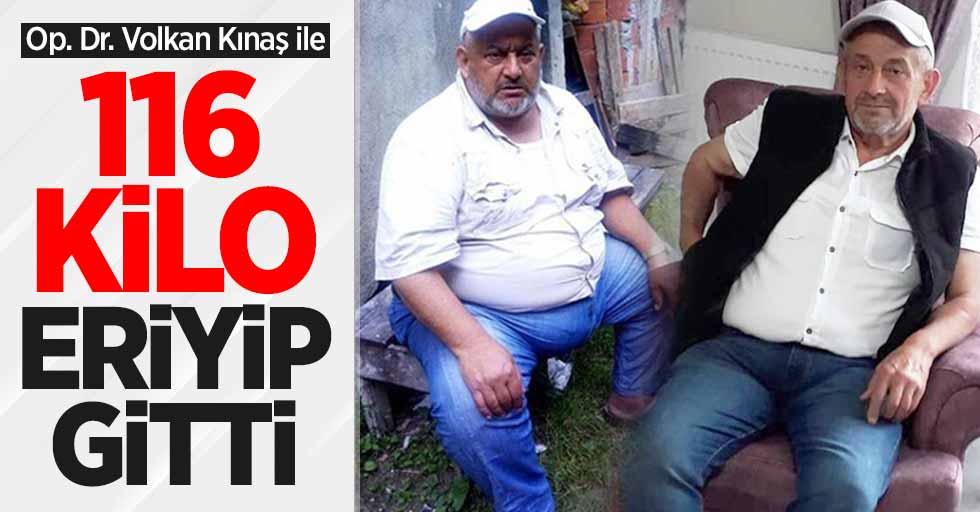 Op. Dr. Volkan Kınaş ile 116 kilo verdi