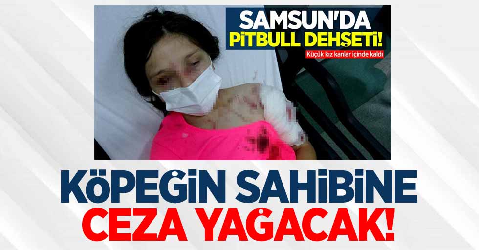 Samsun'da küçük kızı yaralayan pitbullun sahibine ceza yağacak