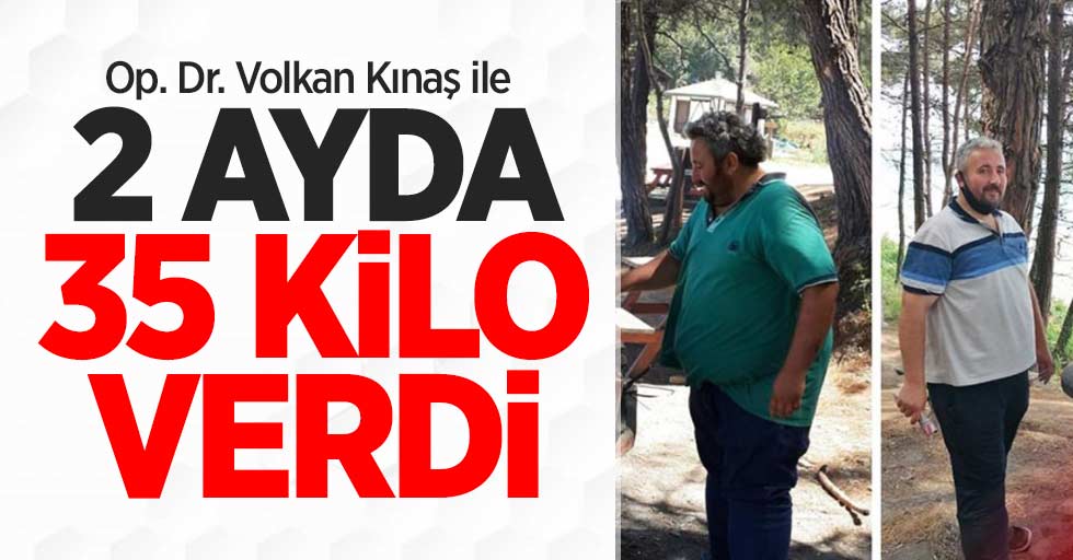 Op. Dr. Volkan Kınaş ile 2 ayda 35 kilo verdi