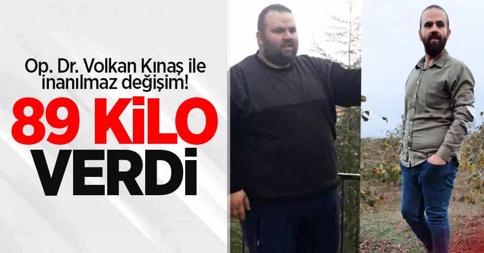 Op. Dr. Volkan Kınaş ile inanılmaz değişim! 89 kilo verdi