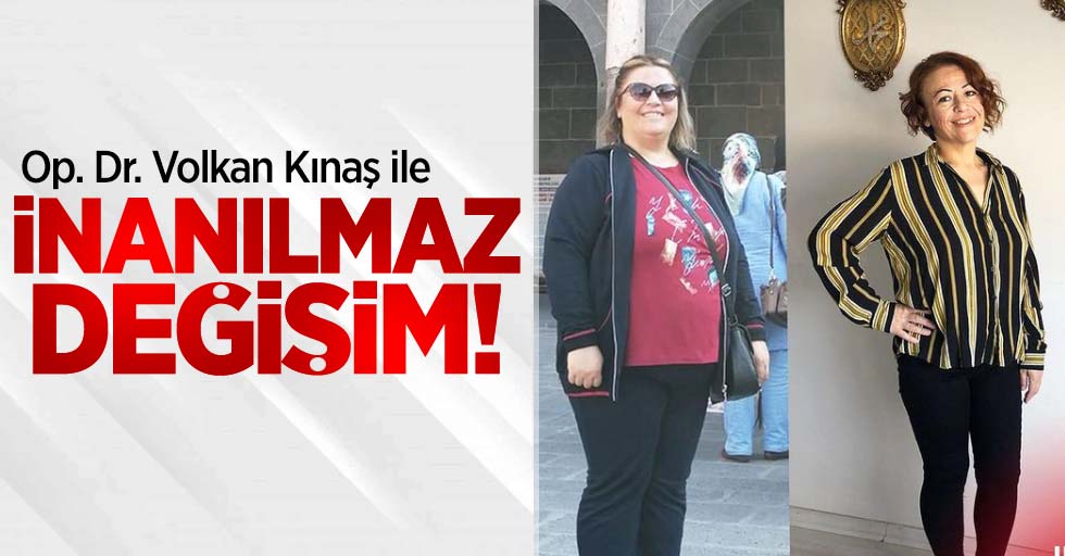 Op. Dr. Volkan Kınaş ile inanılmaz değişim