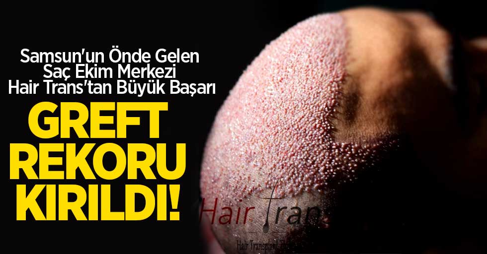 Samsun'un Önde Gelen Saç Ekim Merkezi Hair Trans'tan Büyük Başarı