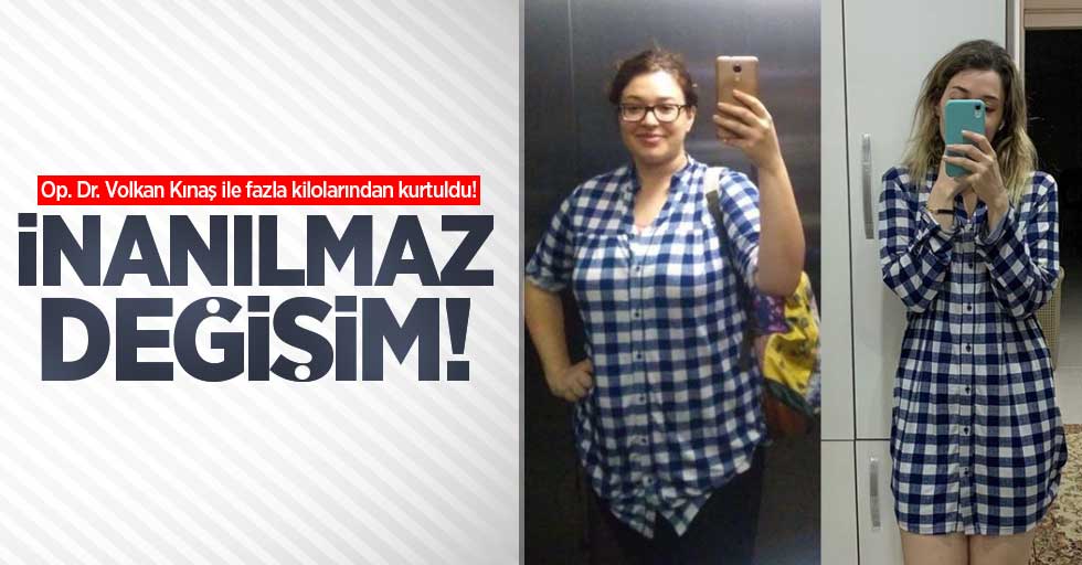 Op. Dr. Volkan Kınaş ile fazla kilolarından kurtuldu! İnanılmaz değişim