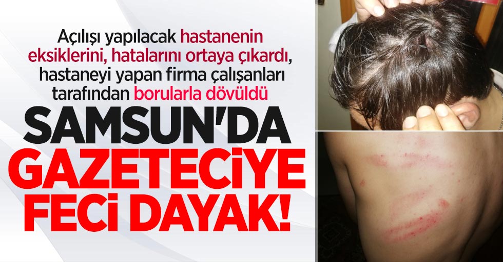 Samsun'da gazeteciye feci dayak! Doğalgaz borusu ile dövdüler