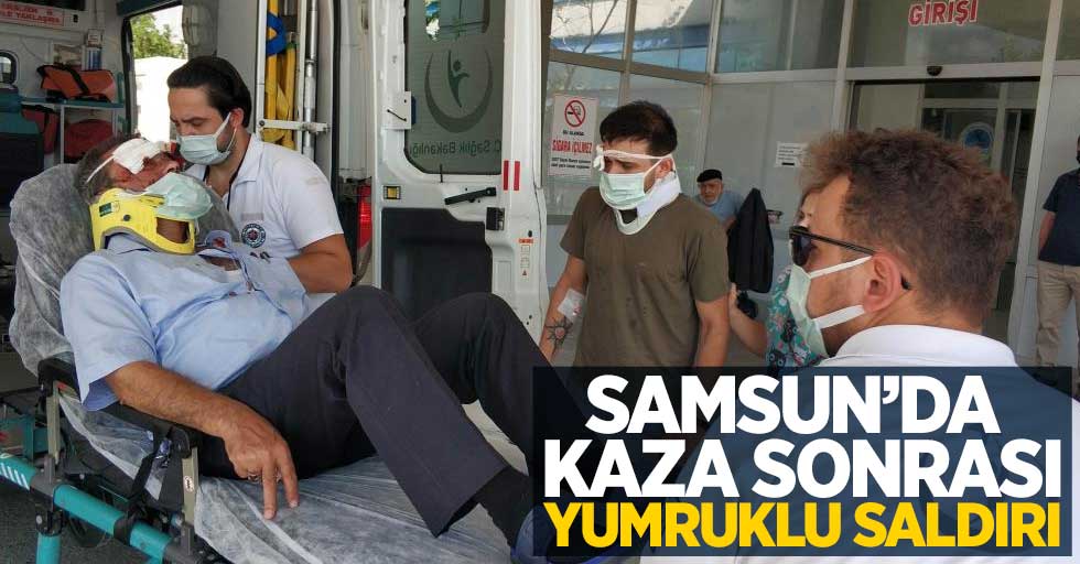 Samsun'da kaza sonrası yumruklu saldırı