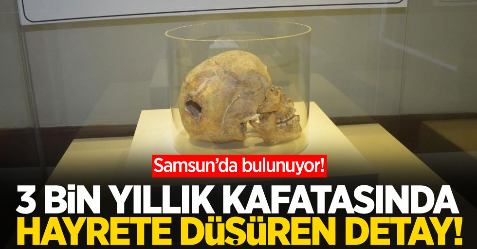 Samsun'da sergileniyor! 3 bin yıllık kafatasında hayrete düşüren detay