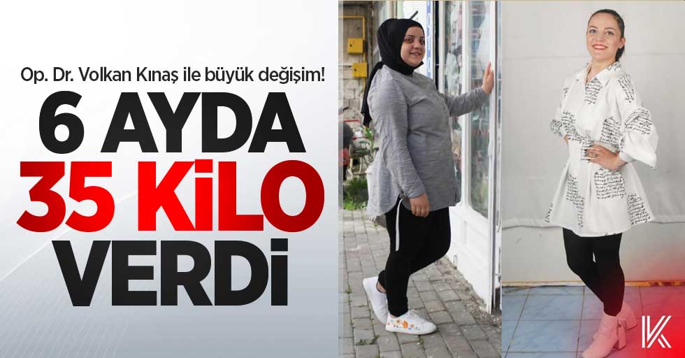 Op. Dr. Volkan Kınaş ile büyük değişim! 6 ayda 35 kilo verdi