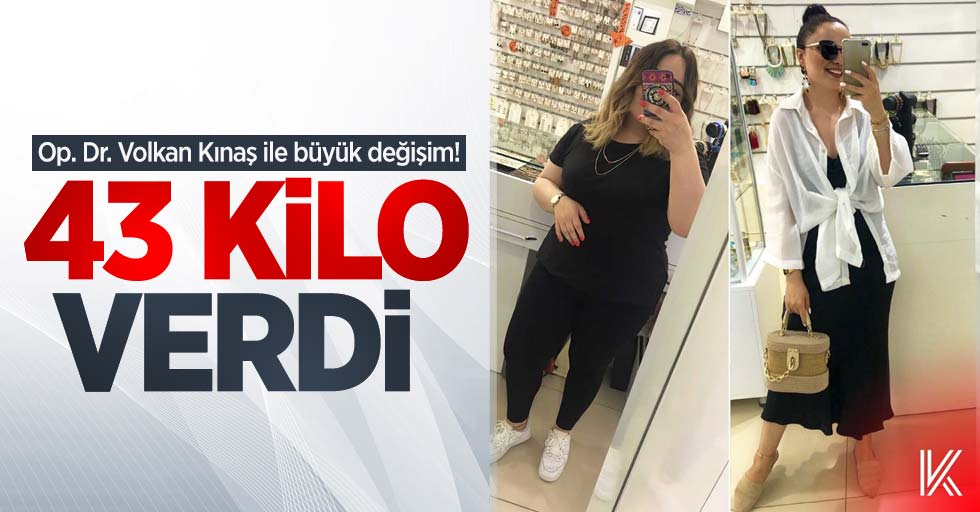 Op. Dr. Volkan Kınaş ile büyük değişim! 43 kilo verdi