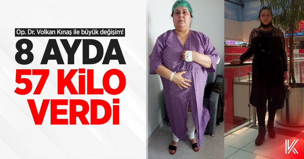 Op. Dr. Volkan Kınaş ile büyük değişim! 8 ayda 57 kilo verdi