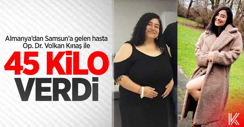 Op. Dr. Volkan Kınaş ile fazla kilolarından kurtuldu! 45 kilo verdi
