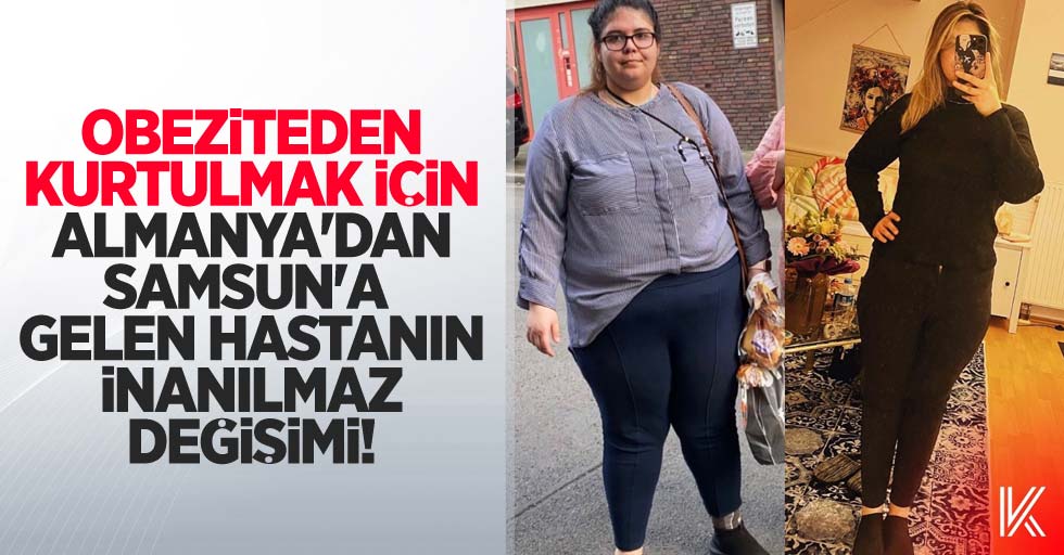 Obeziteden kurtulmak için Almanya'dan Samsun'a geldi