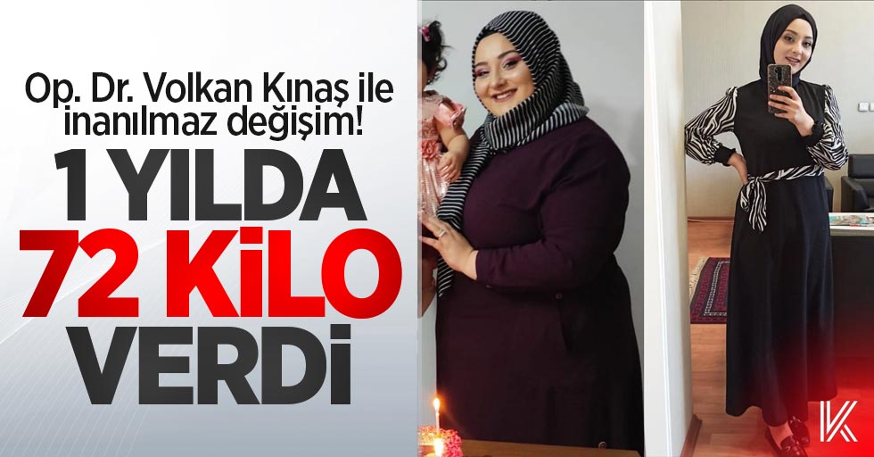 Op. Dr. Volkan Kınaş ile inanılmaz değişim! 1 yılda 72 kilo verdi