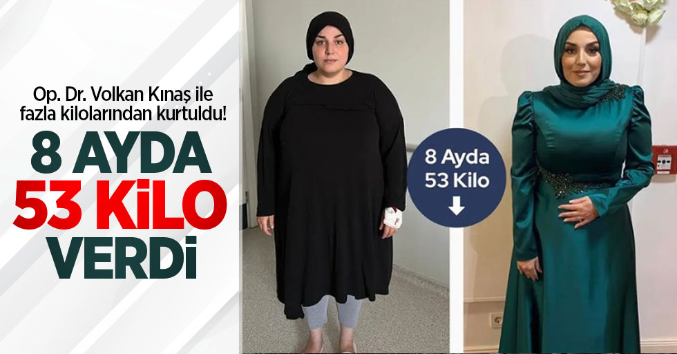 Op. Dr. Volkan Kınaş ile fazla kilolarından kurtuldu! 8 ayda 53 kilo verdi