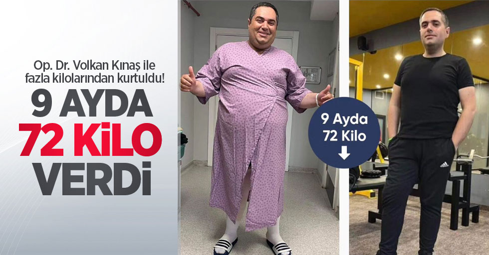 Op. Dr. Volkan Kınaş ile fazla kilolarından kurtuldu! 9 ayda 72 kilo verdi
