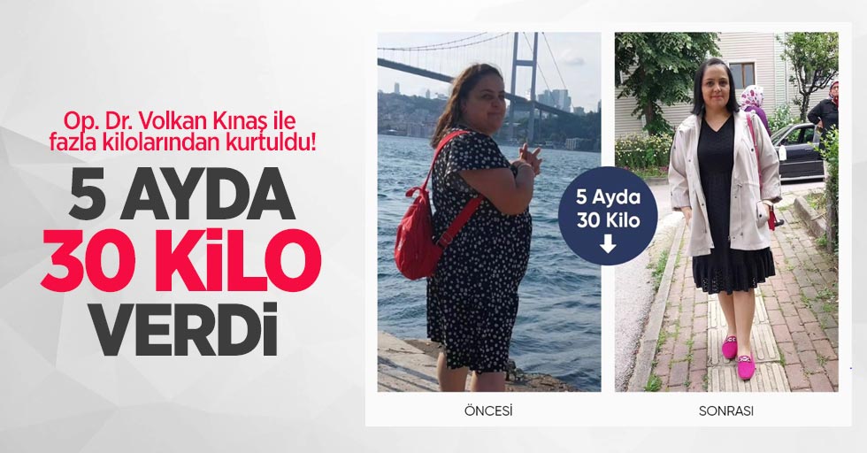 Op. Dr. Volkan Kınaş ile fazla kilolarından kurtuldu! 5 ayda 30 kilo verdi