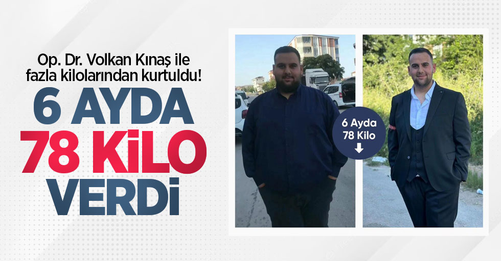 Op. Dr. Volkan Kınaş ile fazla kilolarından kurtuldu! 6 ayda 78 kilo verdi