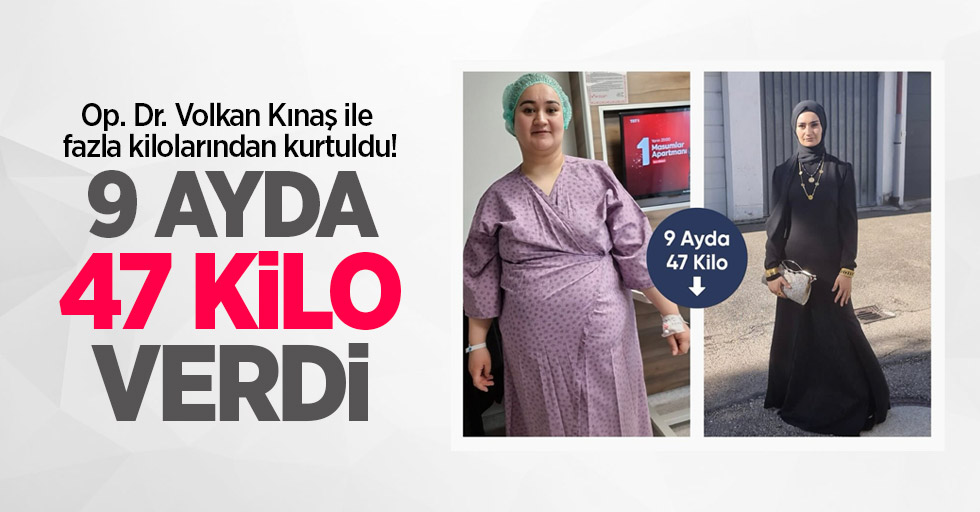Op. Dr. Volkan Kınaş ile fazla kilolarından kurtuldu! 9 ayda 47 kilo verdi