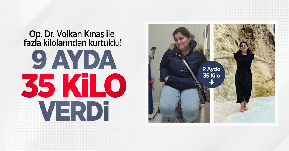 Op. Dr. Volkan Kınaş ile fazla kilolarından kurtuldu! 9 ayda 35 kilo verdi