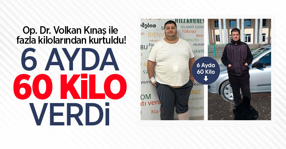 Op. Dr. Volkan Kınaş ile fazla kilolarından kurtuldu! 6 ayda 60 kilo verdi