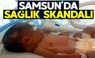 Samsun'da sağlık skandalı
