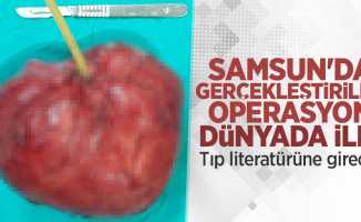 Samsun'da gerçekleştirilen operasyon dünyada ilk! 