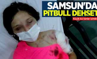 Samsun'da pitbull dehşeti! Küçük kız kanlar içinde kaldı