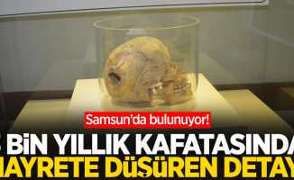 Samsun'da sergileniyor! 3 bin yıllık kafatasında hayrete düşüren detay