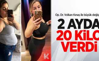 Op. Dr. Volkan Kınaş ile büyük değişim! 2 ayda 20 kilo verdi