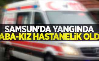 Samsun'da yangında baba-kız hastanelik oldu