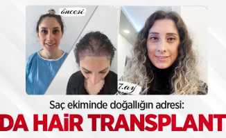 Saç ekiminde doğallığın adresi: DA Hair Transplant