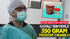 22 yıllık doktor ilk kez şahit oldu: Kapalı yöntemle 350 gram prostat çıkarıldı